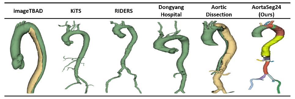 Aorta25_2.png